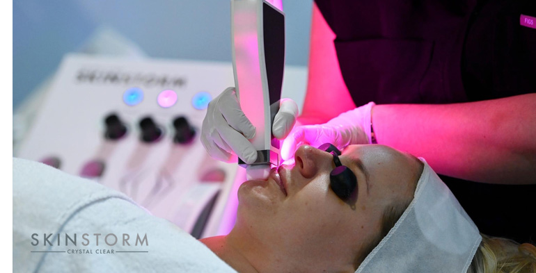 SKINSTORM by Crystal Clear